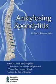 Ankylosing Spondylitis byWeisman, Michael H.; Vedd meg online